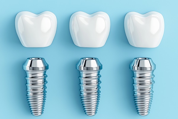 Oral Surgery: Who Is A Candidate For Dental Implants?